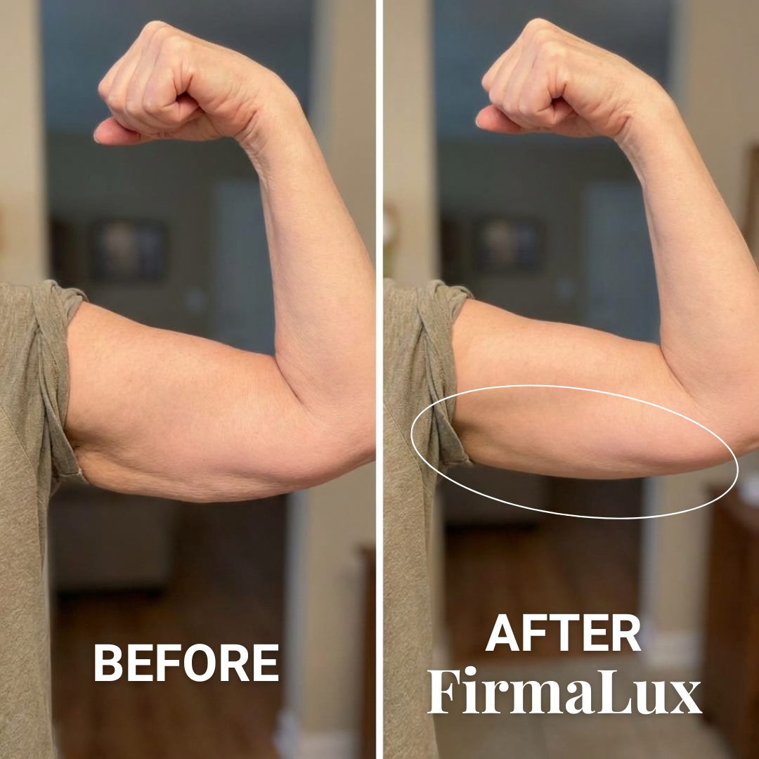 FirmaLux™ Device