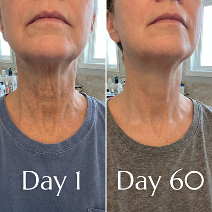 Ovaliss Neck Balm