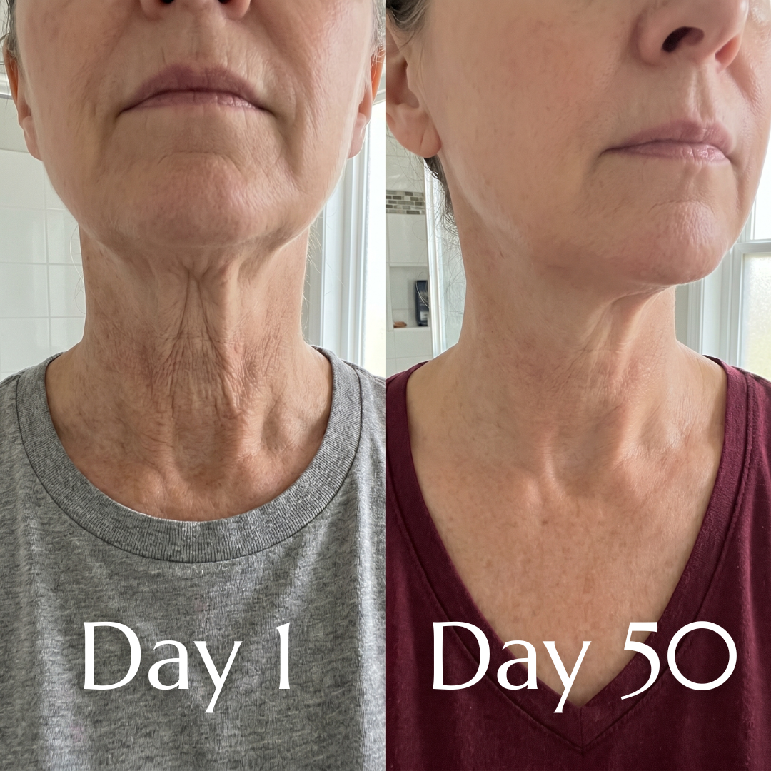 Ovaliss Neck Balm