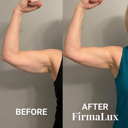 FirmaLux™ Device