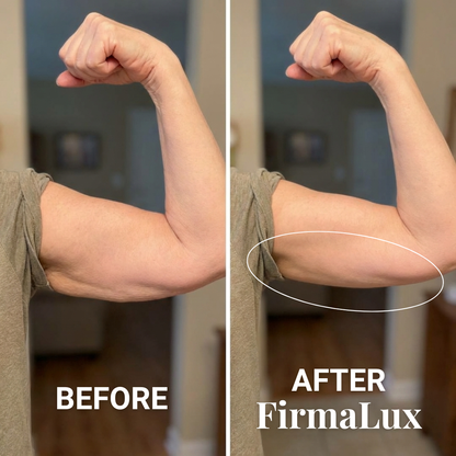 FirmaLux™ Device