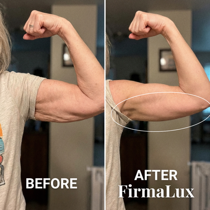 FirmaLux™ Device